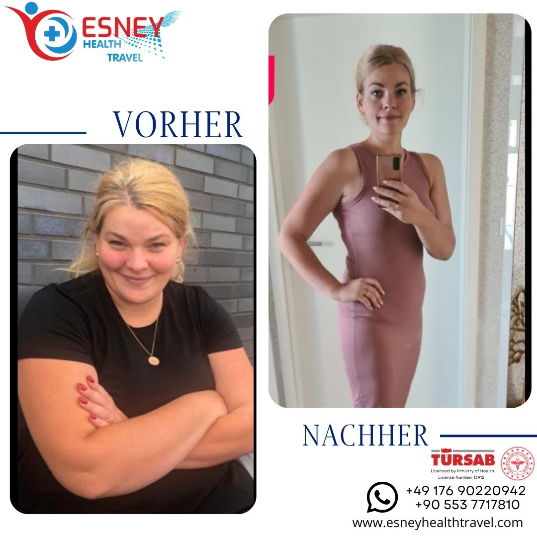 vorher-nachher-1