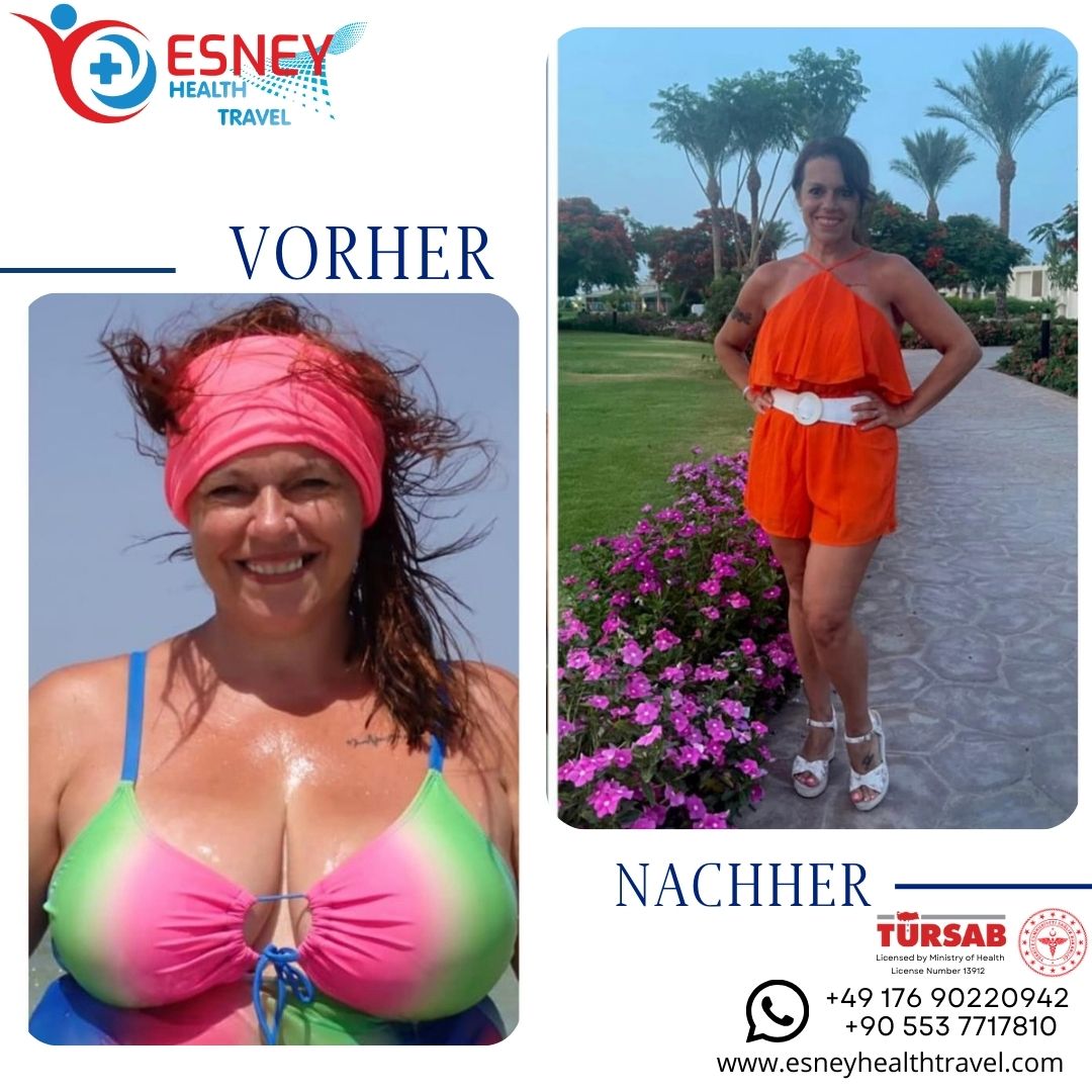 vorher-nachher-2