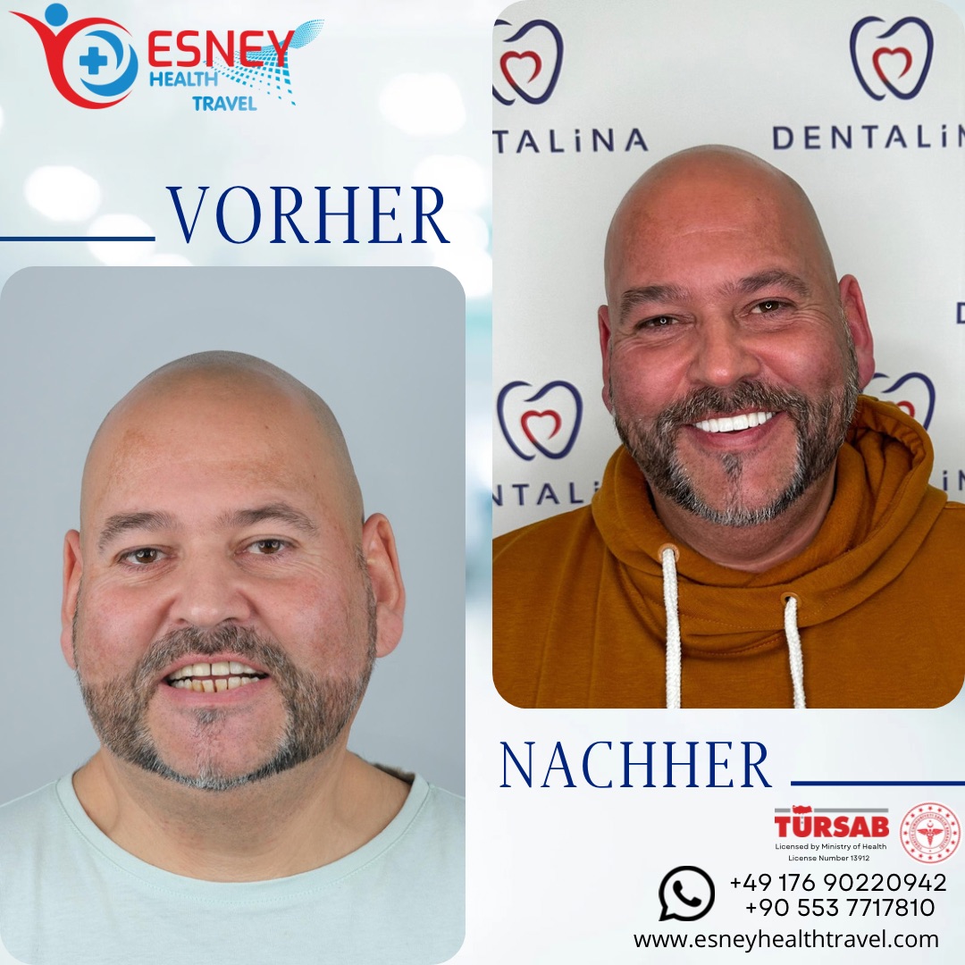 Zahnbehandlung-3